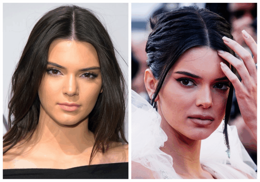 τι άλλαξε στο πρόσωπο της η Kendall