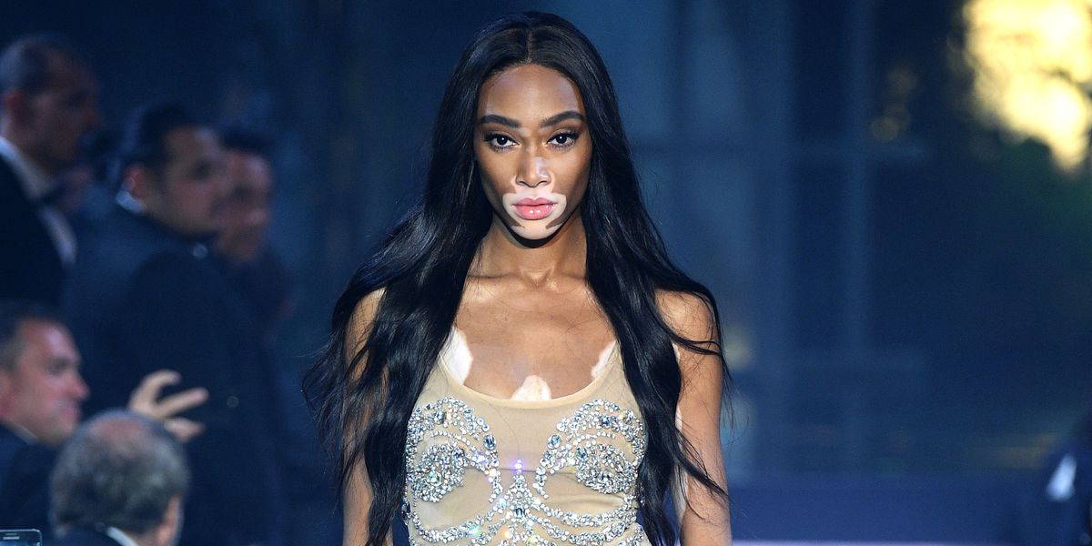 H Winnie Harlow ξέσπασε σε κλάματα μόλις της ανακοίνωσαν πως είναι το νεό αγγελάκι της Victoria’s Secret