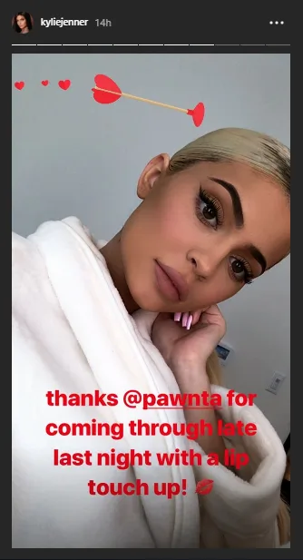 Kylie Jenner έβαλε ξανά filler στα χείλια της