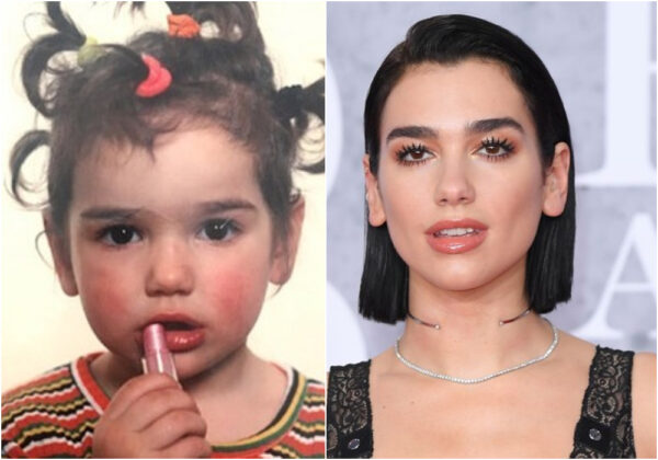 H Dua Lipa κατηγορείται για photoshop στα χείλη της σε παιδικές της φωτογραφίες!