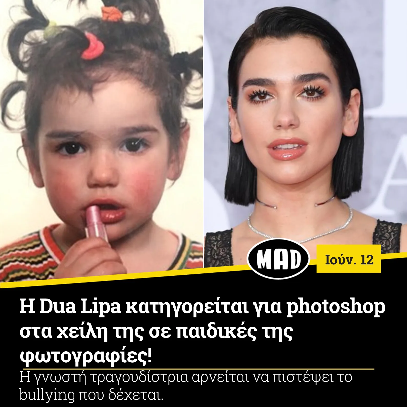 Κολάζ με παιδική φωτογραφία της Dua Lipa και πρόσφατη εμφάνισή της.