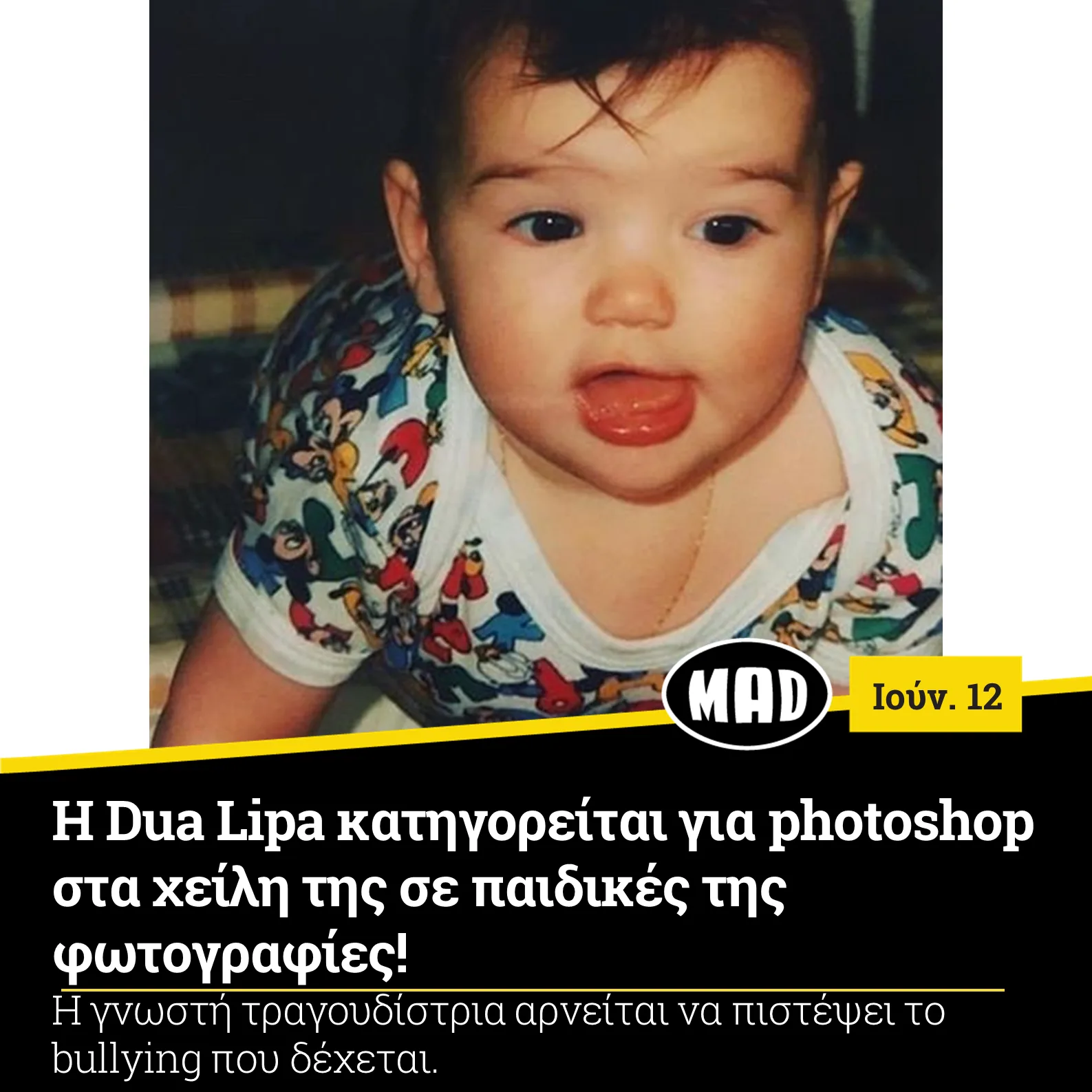 Παιδική φωτογραφία της Dua Lipa σε νηπιακή ηλικία.