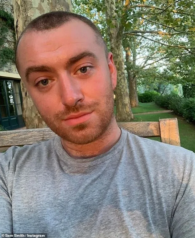Sam Smith κάνει μεταμόσχευση μαλλιών