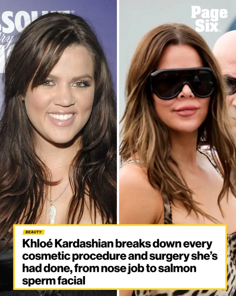 Κολάζ με την Khloé Kardashian πριν και μετά από αισθητικές επεμβάσεις.