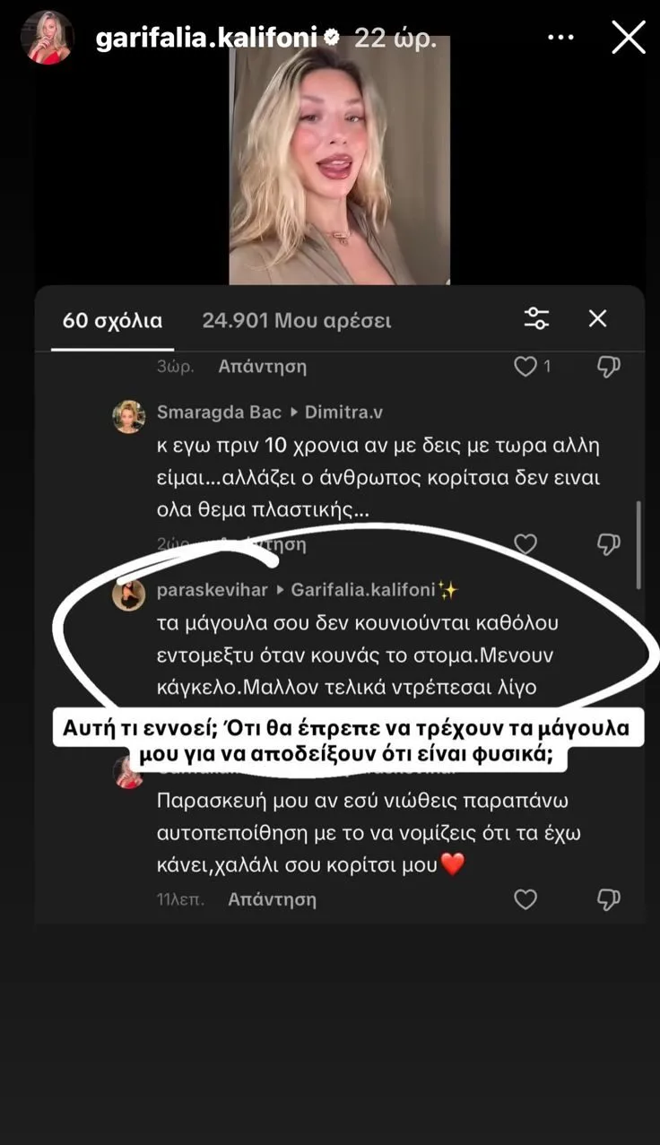 Η Γαρυφαλλιά Καληφώνη απαντά σε σχόλια για το πρόσωπό της, αναφέροντας τη διαφορά της από το GNTM.