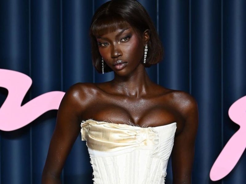 Anok Yai: Από την πασαρέλα στο χειρουργείο για κρίσιμη επέμβαση στους πνεύμονες