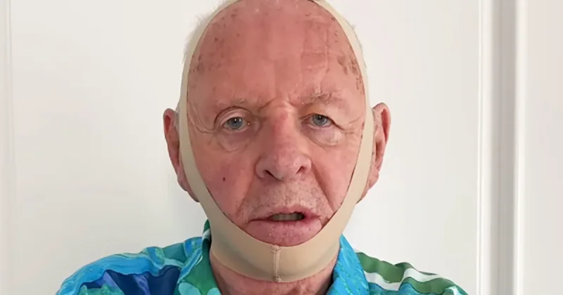 Ο Anthony Hopkins με ελαστικό επίδεσμο στο πρόσωπο.