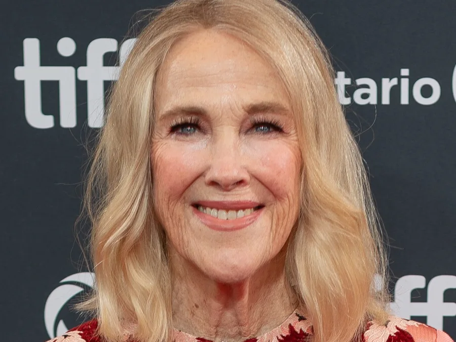 Πορτρέτο της ηθοποιού Catherine O’Hara η οποία έπασχε από τη σπάνια πάθηση Situs inversus.