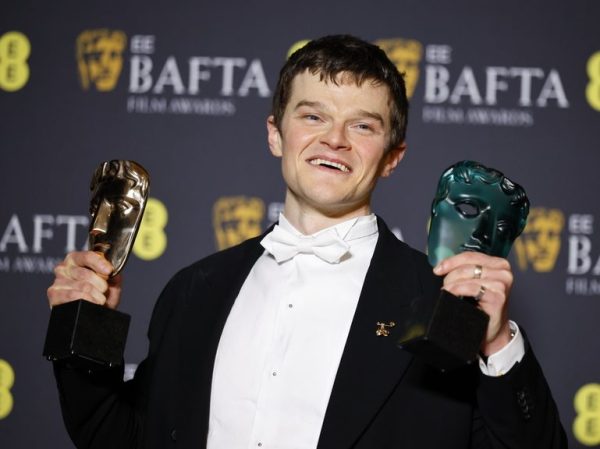 BAFTA 2026: Η ανατροπή της χρονιάς με τον Robert Aramayo να αφήνει πίσω DiCaprio και Chalamet